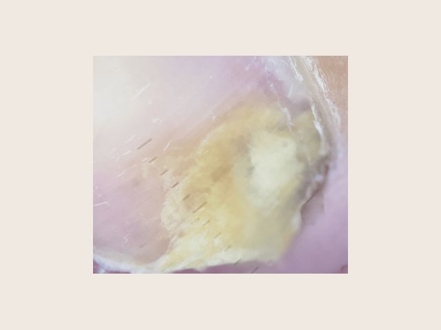 Gros plan en lumière polarisée : dans la moitié basse de l'image, plage jaune opaque et rugueuse, blanchâtre en son centre, aux bords flous ; le reste de la tablette est rose et lisse.